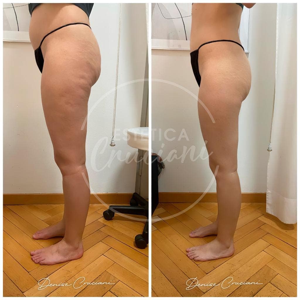 Caldera Forms Preview